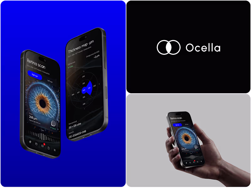 Cover image for Ocella Eye Exam Results Portal

Clear