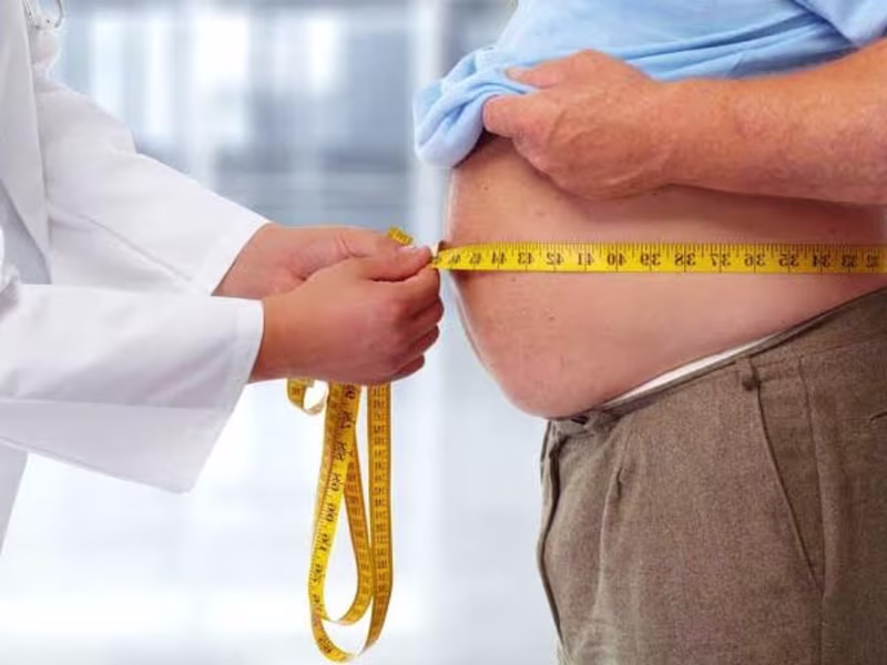 Cover image for LIFE IN OBESITY 