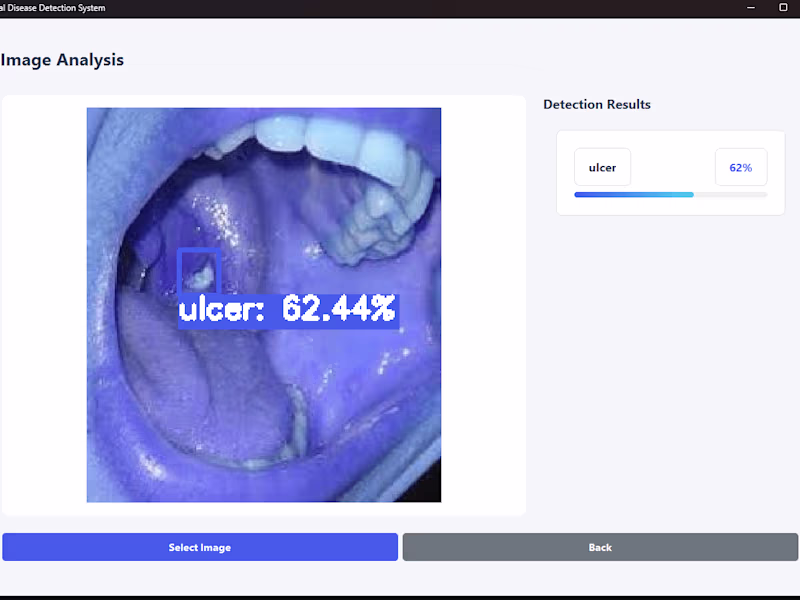 Cover image for AI-Powered Oral Disease Detection System