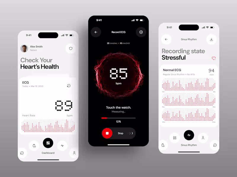 Cover image for ECG Monitoring Mobile App