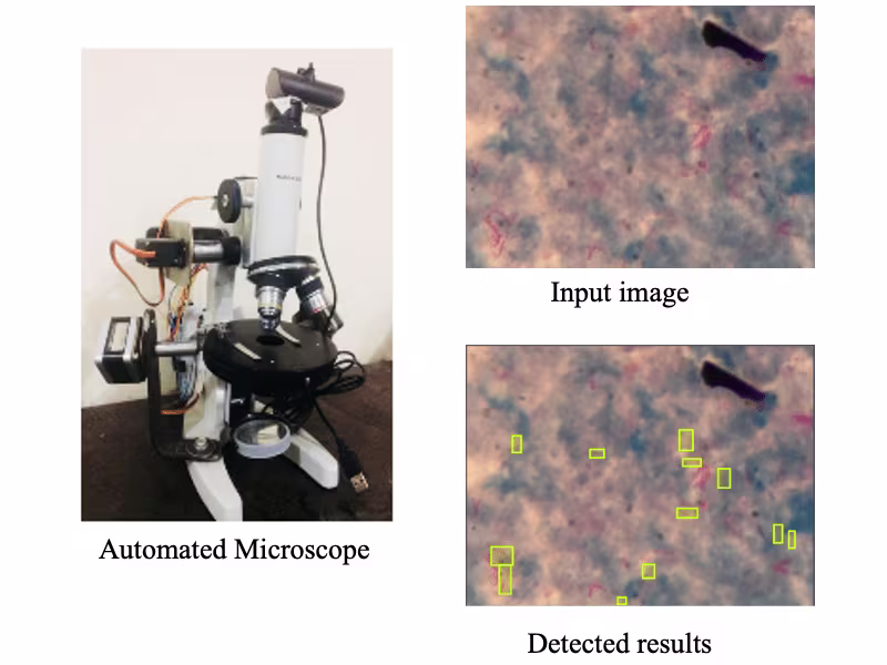 Cover image for Automated Microscope for Tuberculosis Detection