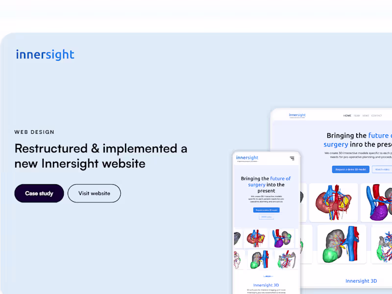 Cover image for UX/UI Design for Framer