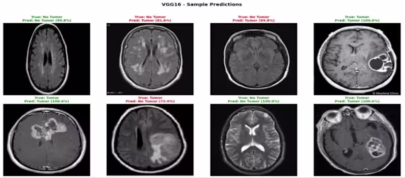 Cover image for Automated Brain Tumor Detection (VGG16)