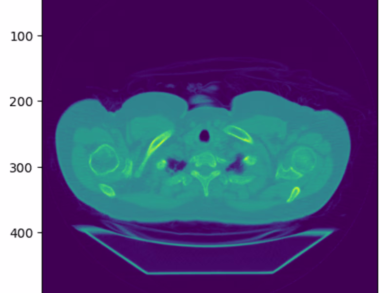 Cover image for Biomedical Image Analysis