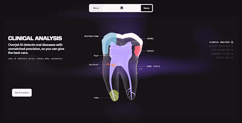Cover image for overjet.com