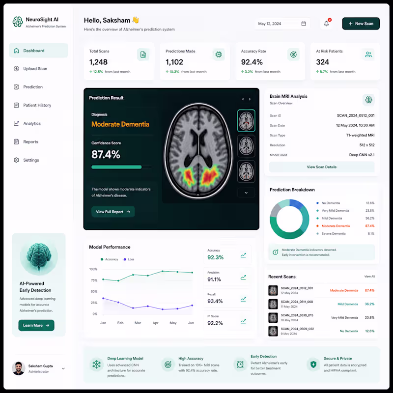 Cover image for Developed an AI-driven Alzheimer’s disease