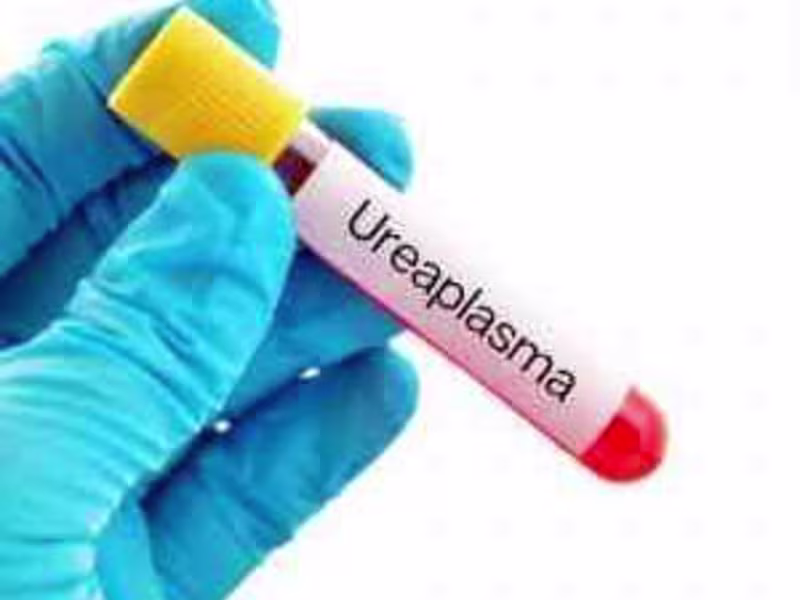 Cover image for Private Ureaplasma Testing
-Walk-in Appointments Available 