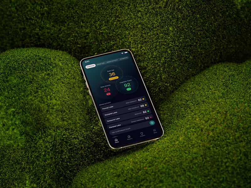 Cover image for Brain Health Data UX Design for MYndspan