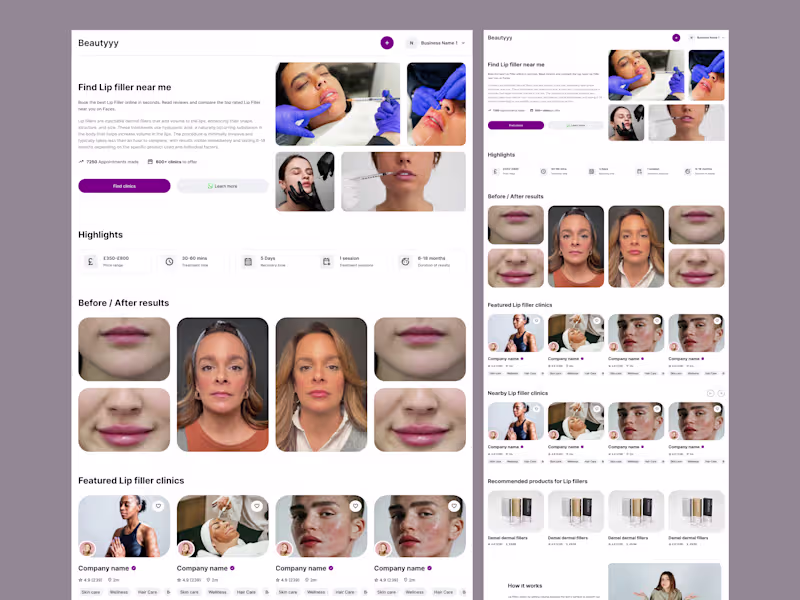 Cover image for Lip Filler Clinic Website Design