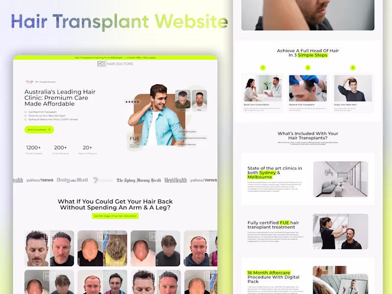 Cover image for Modern Hair Transplant Website Design: Attract More Clients