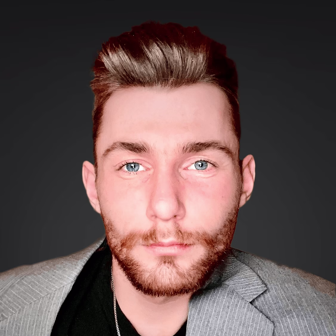 Placeholder project card media