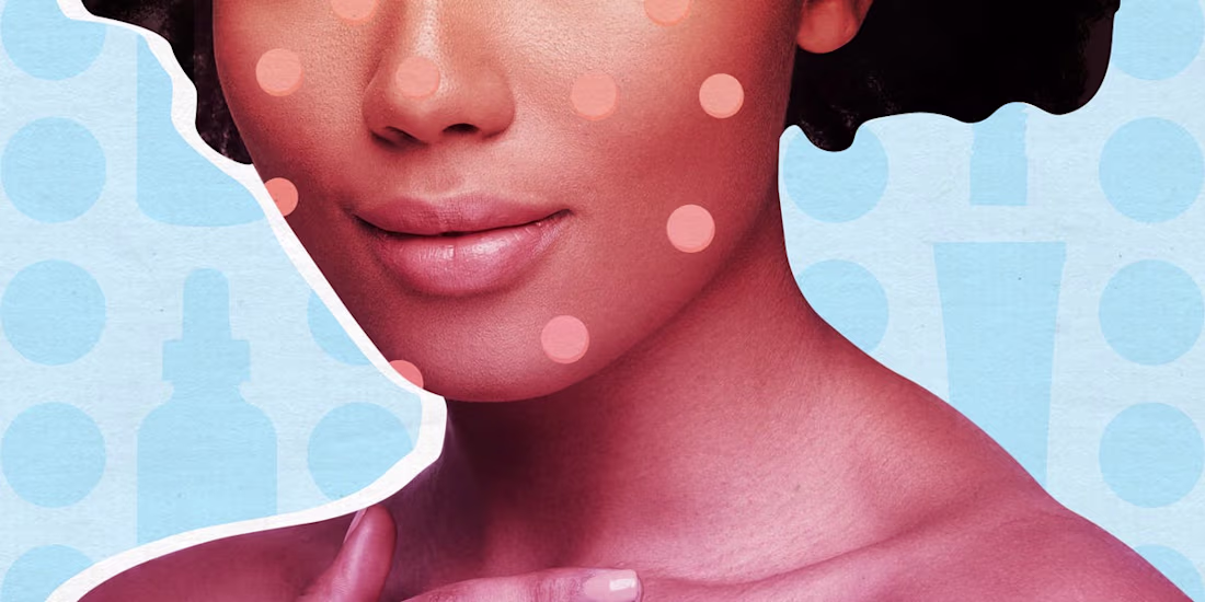 Cover image for Best acne spot treatments of 2020, according to Experts