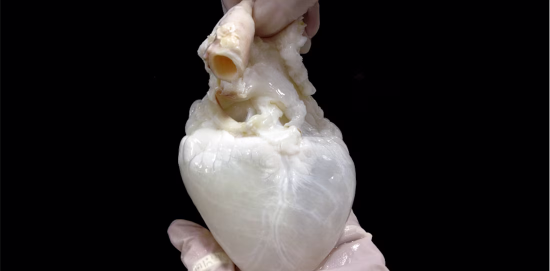 Cover image for Lab-grown ‘ghost hearts’ work to solve organ transplant shortag…