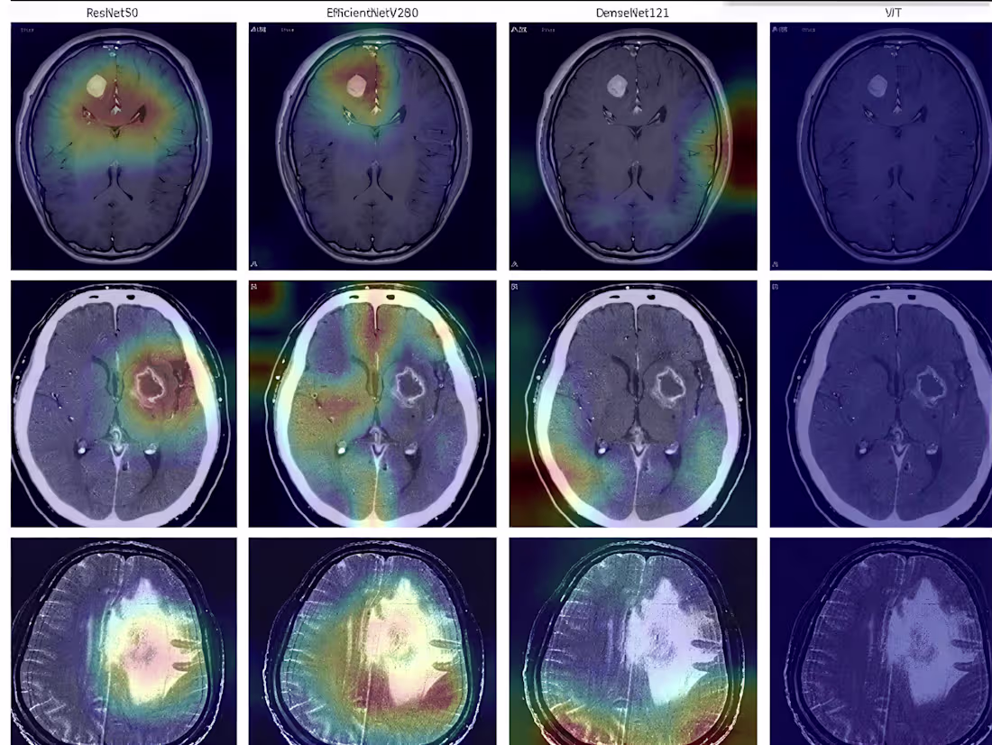 Cover image for "Beyond the Scan: Enhancing Brain