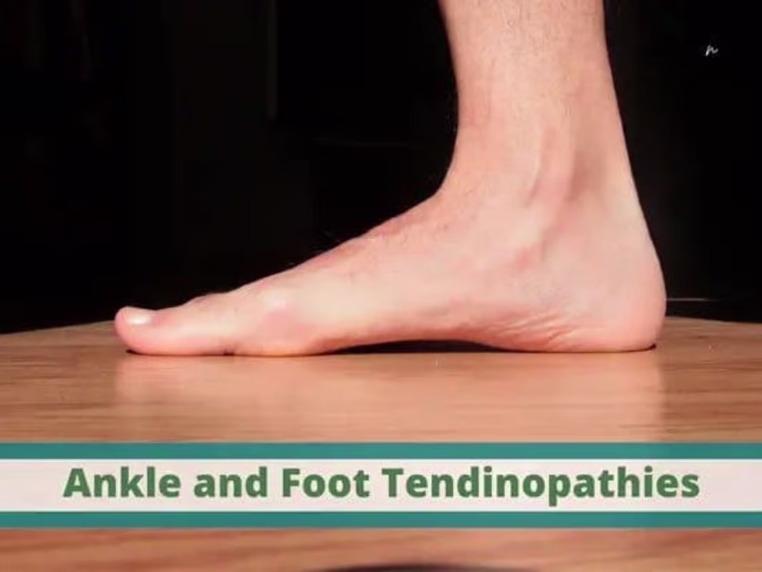 Cover image for Running on the Edge: Understanding and Treating Tendinopathies …