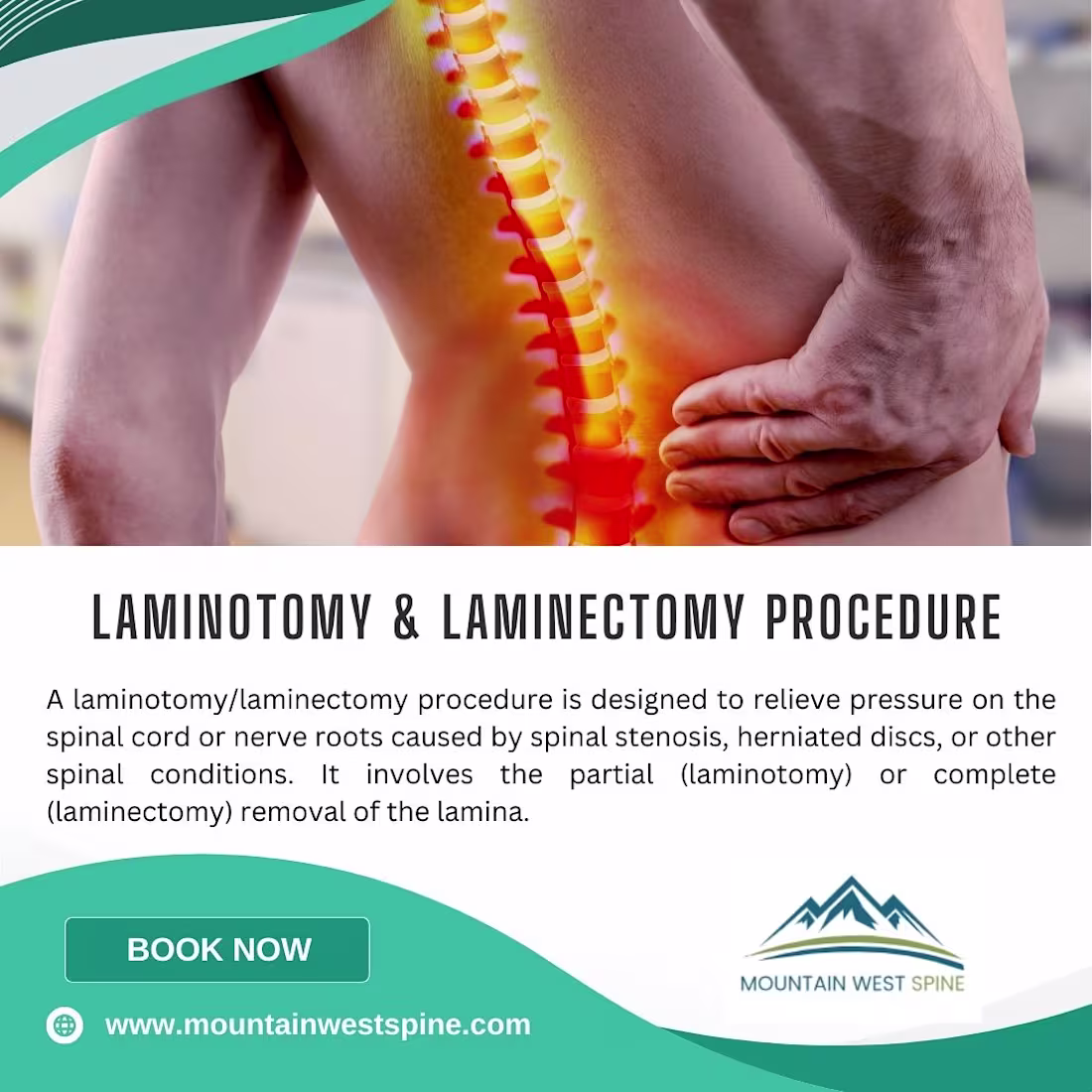 Cover image for Laminotomy/Laminectomy Surgical Solutions at Mountain West Spine