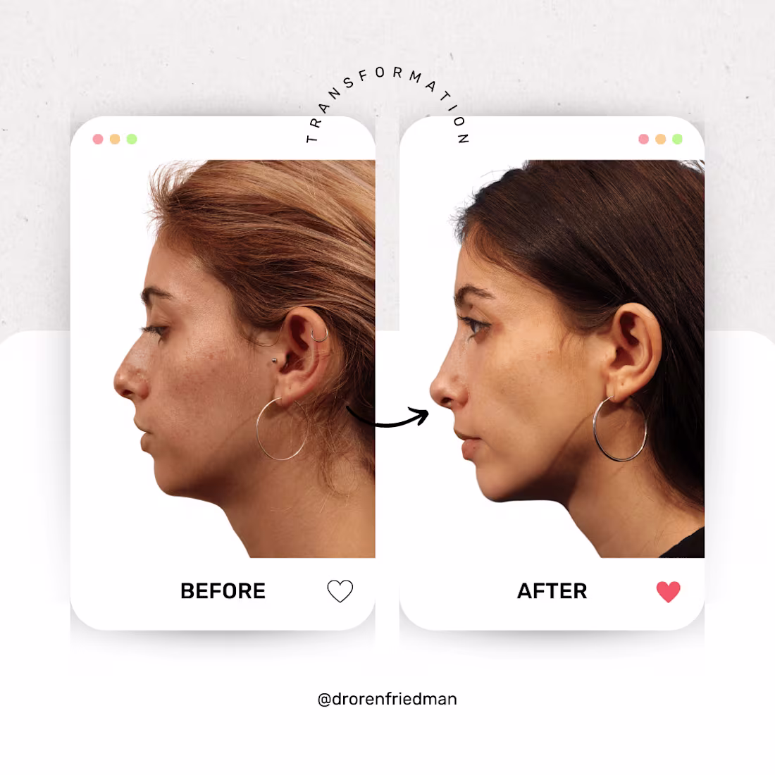 Cover image for Social Media Templates- Penn Medicine