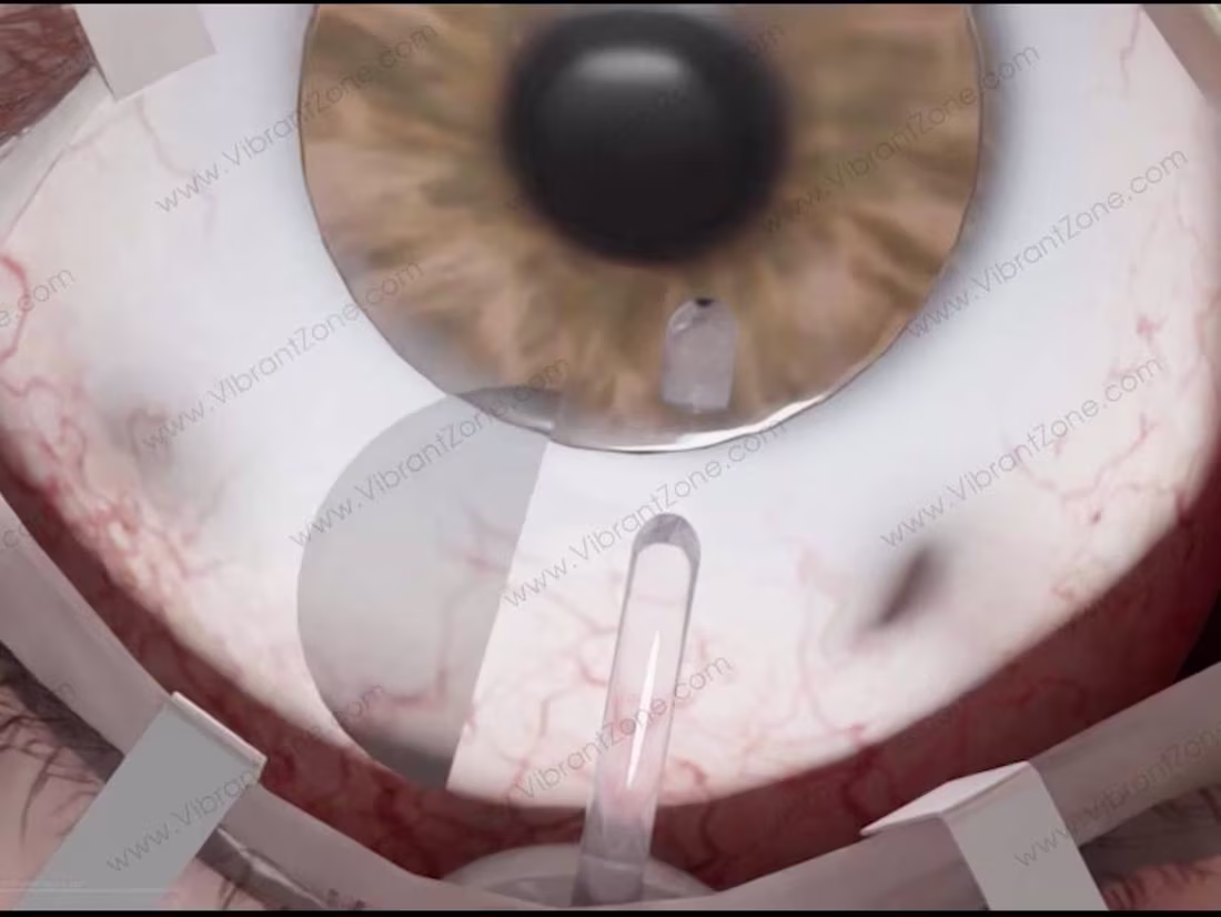 Cover image for 3D Medical Animation