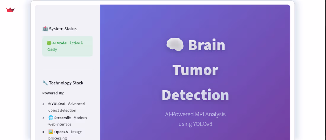 Cover image for AI-Based Brain Tumor Detection System