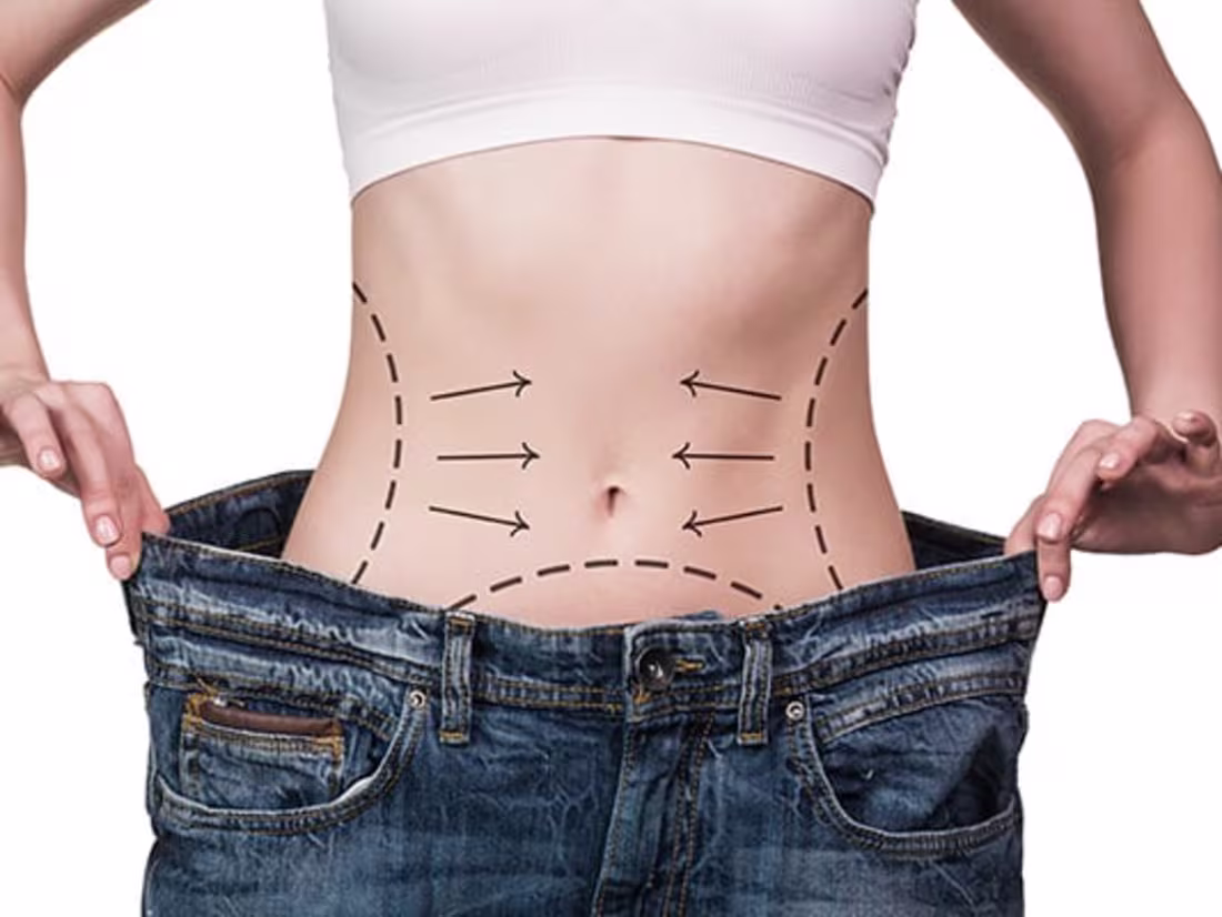 Cover image for Mommy Makeover - Technical Explanation