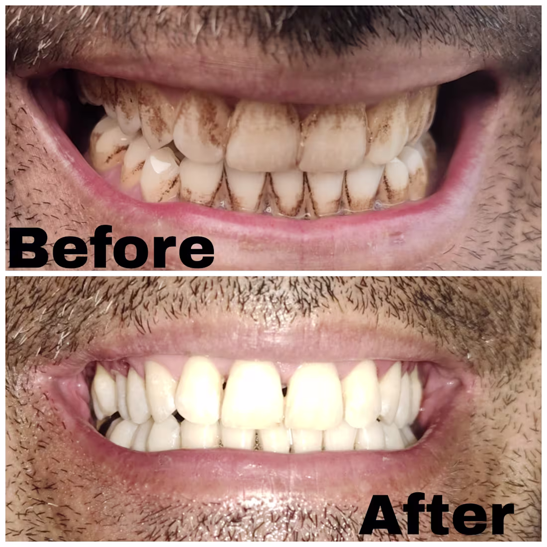 Cover image for Expert Dental Technician | Specialized