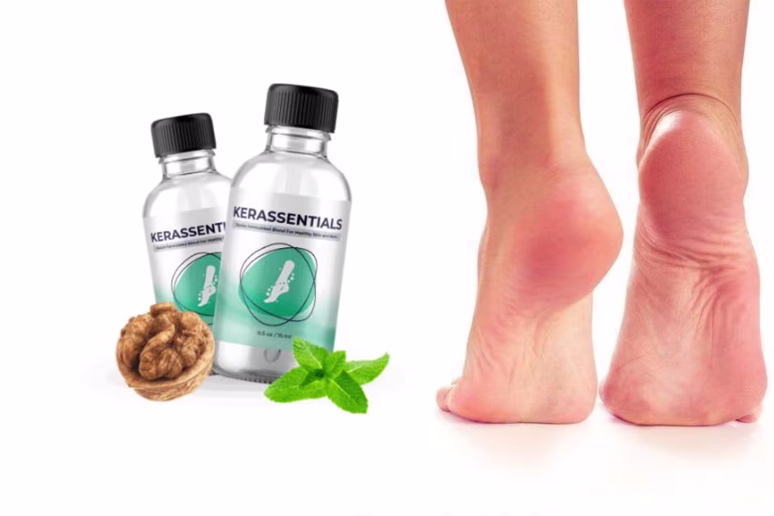 Cover image for Kerassentials Reviews SCAM EXPOSED By People!