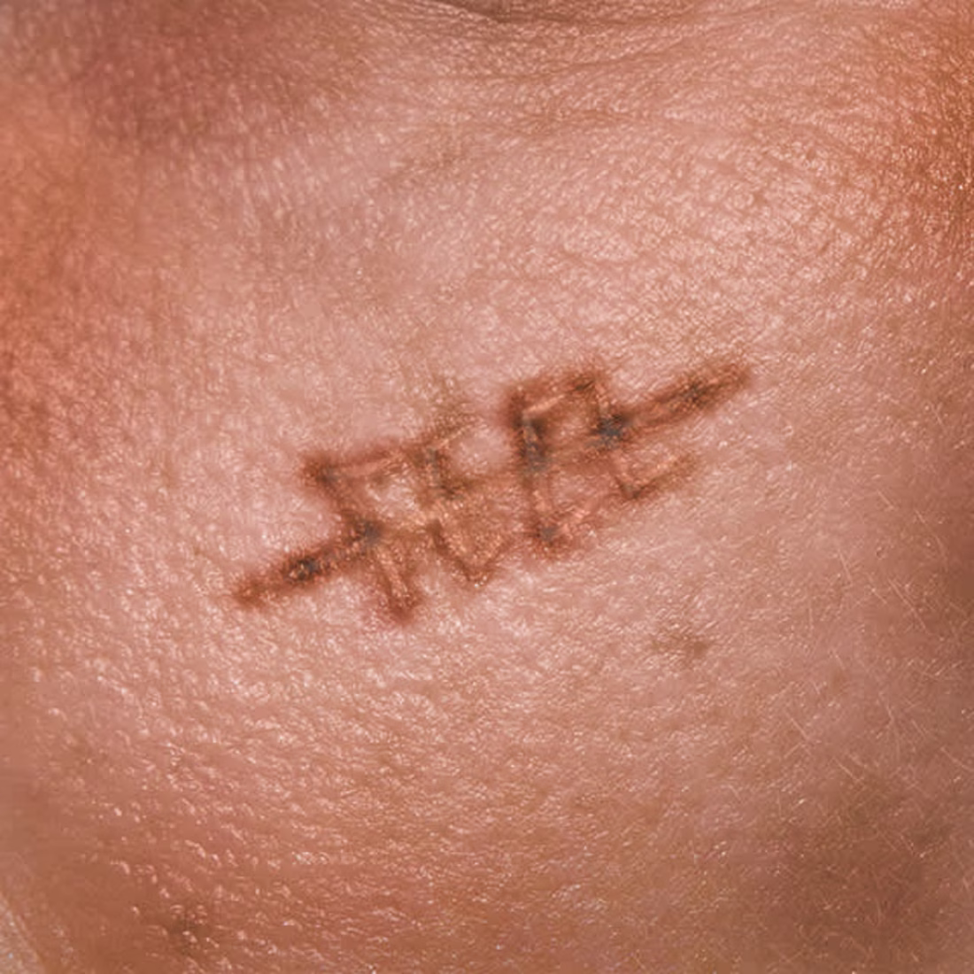 Cover image for "Cicatrici d'autore" song cover 