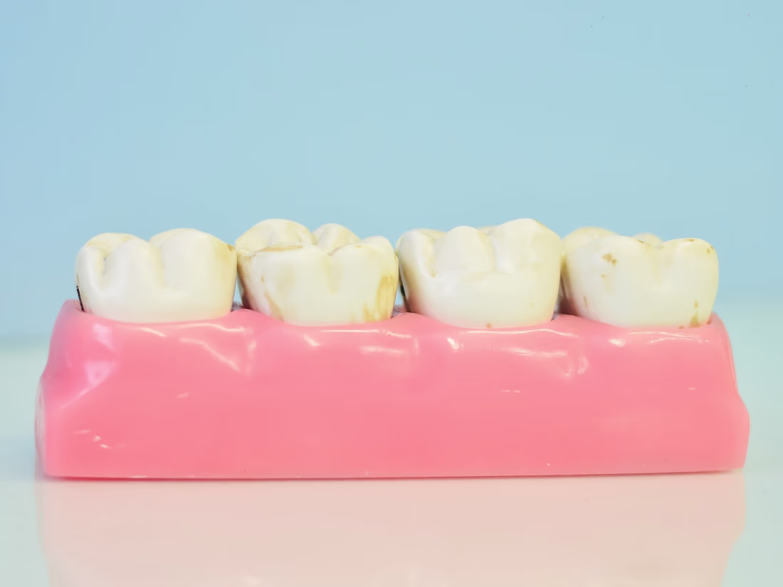 Cover image for Instagram Content for Holistic Dentistry