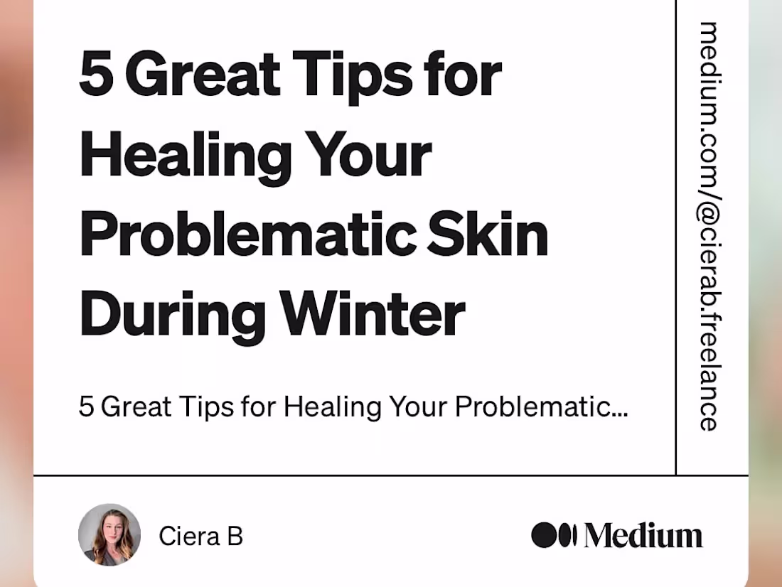 Cover image for Published Blog Post. 