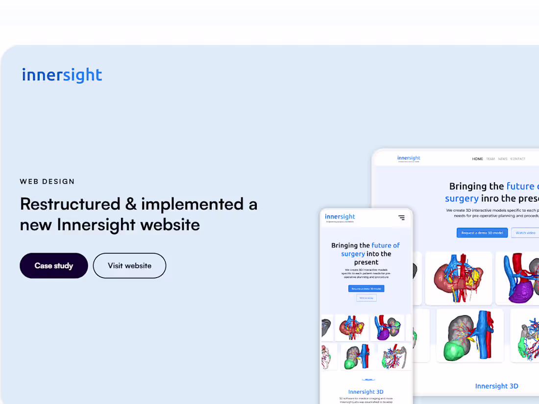 Cover image for UX/UI Design for Framer