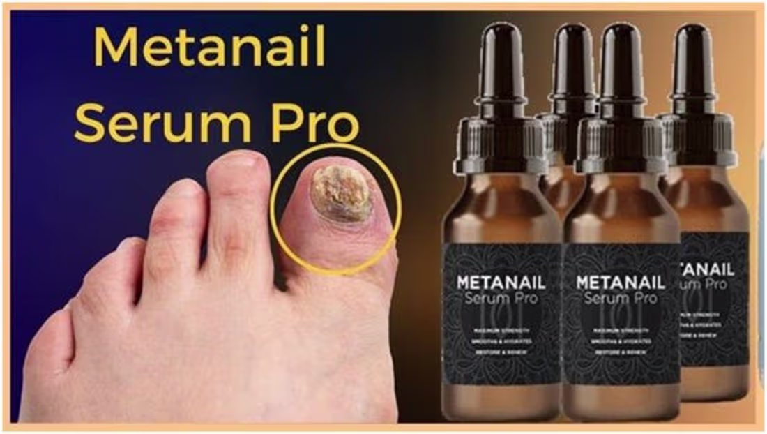Cover image for Introducing Metanail Serum Pro: Revolutionizing Nail Care