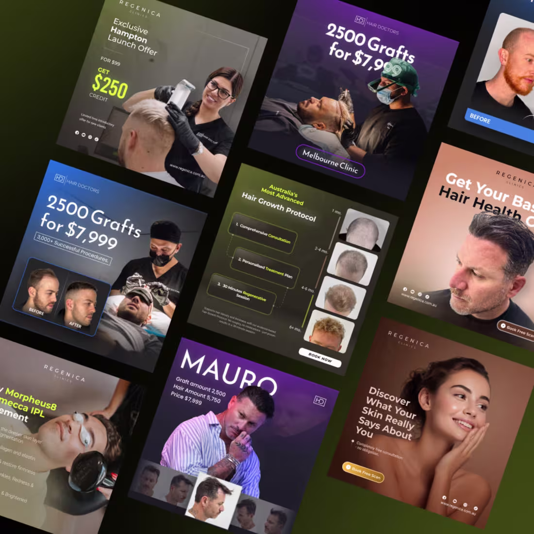 Cover image for 🧠 Social Media Ad Designs for Regenica Clinic | Hair Doctor...