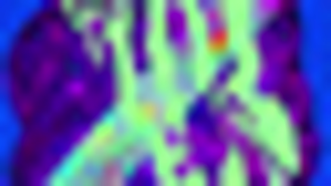 Cover image for Ross - Social Ads