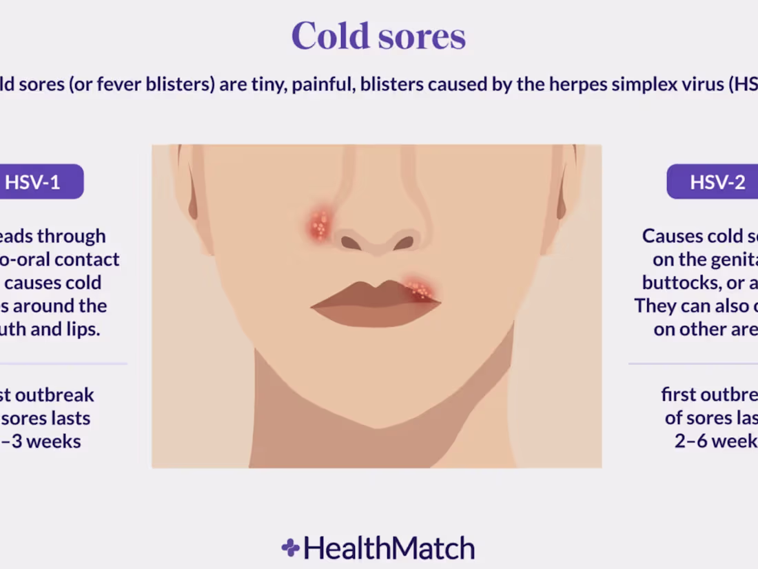 Cover image for Writing: Herpes: An Unexpected Cancer Therapy