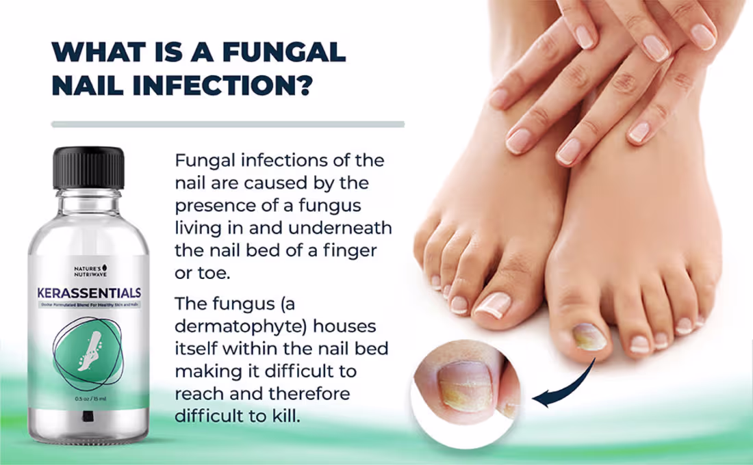 Cover image for Kerassentials – (I’ve Tested) – My Honest Experience!