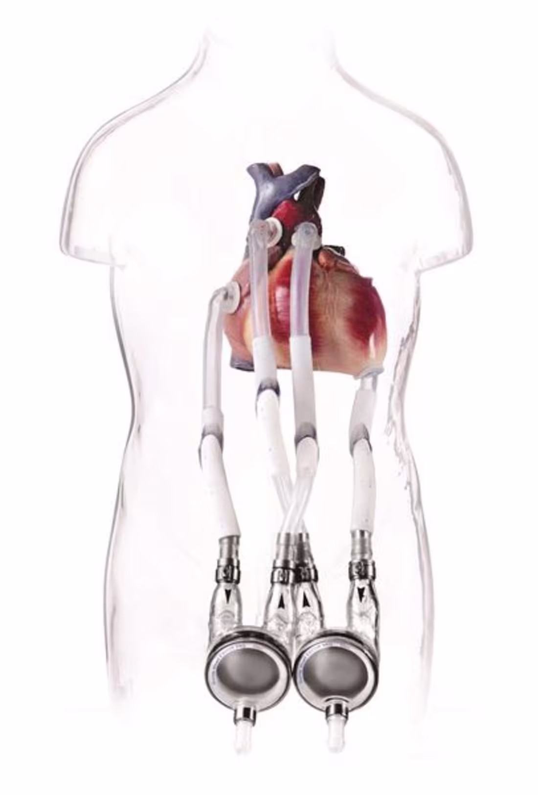 Cover image for Engaging Blog Post for a Cardiac Device Company