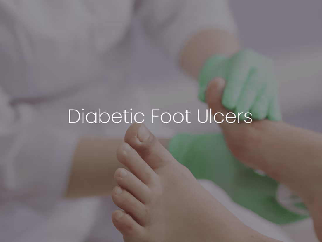 Cover image for Diabetic Foot Ulcers | MetroHealth Be SimplyWell