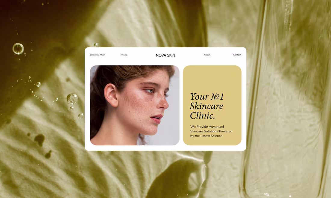 Cover image for Web Design Concept – Skincare Clinic