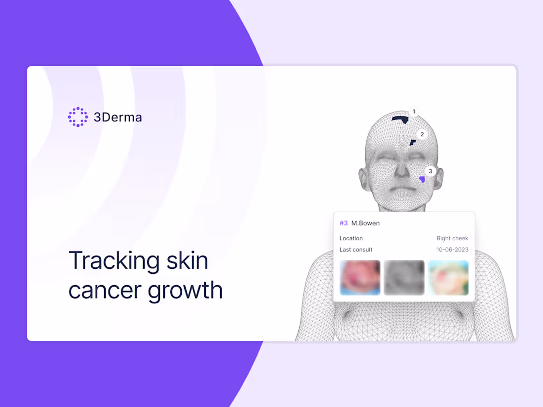 Cover image for Analyze skin lesions to help detect early signs of skin cancer