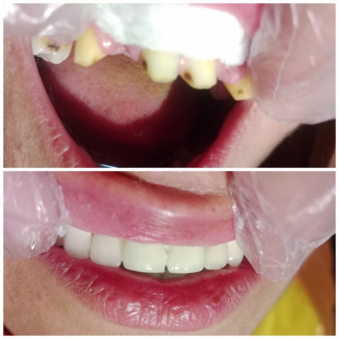 Cover image for "Dental Bridge Fabrication: Successfully restored