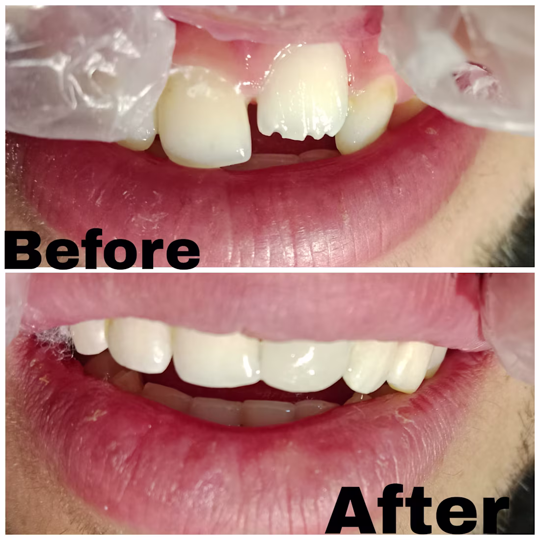 Cover image for "Dental Scaling and Polishing: Transforming