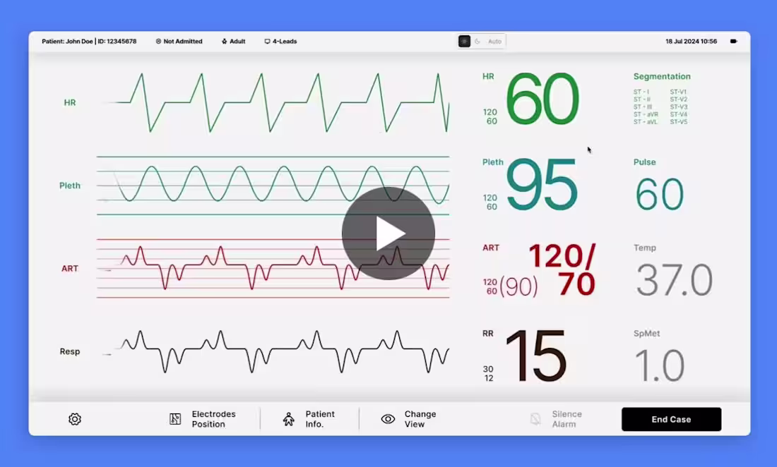 Cover image for ECG Monitor design
