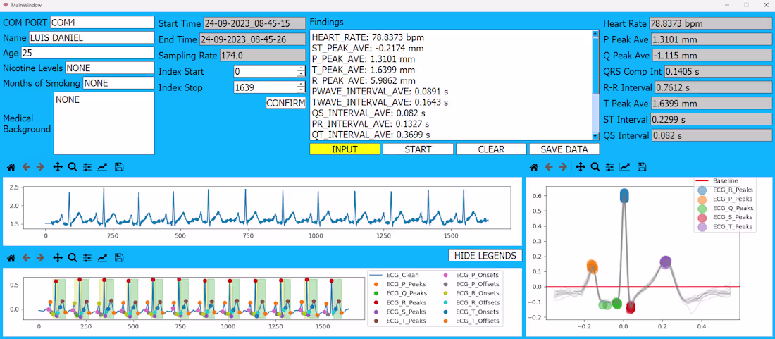 Cover image for Real-Time Detection and Classification of Heart Arrhythmia