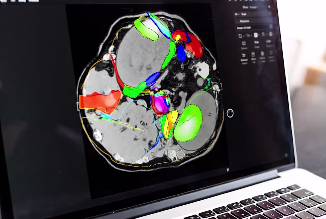 Cover image for Semantic Segmentation Annotation