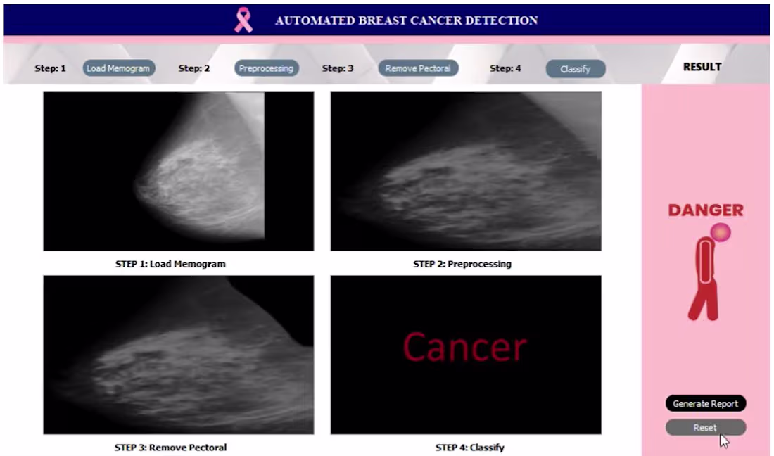 Cover image for Breast Cancer Detection Application