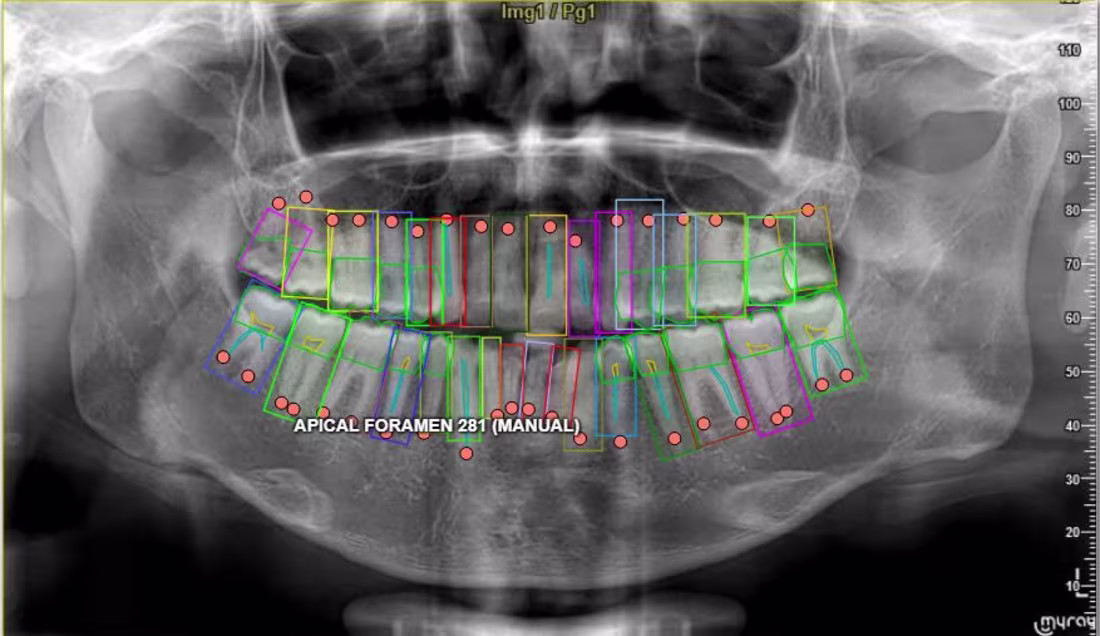 Cover image for Annotated complex dental X-ray medical