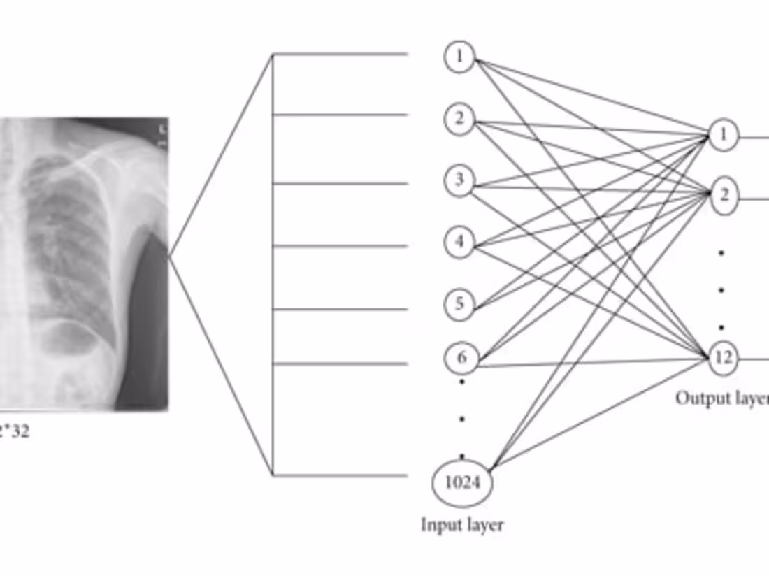 Cover image for Machine Learning Models to Detect COVID-19