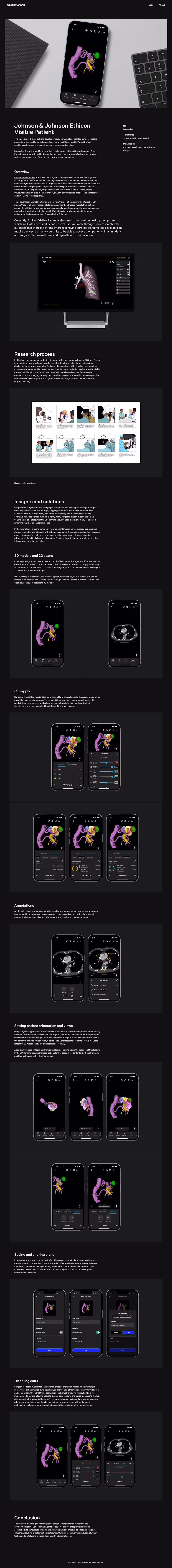 Cover image for Johnson & Johnson Ethicon Visible Patient