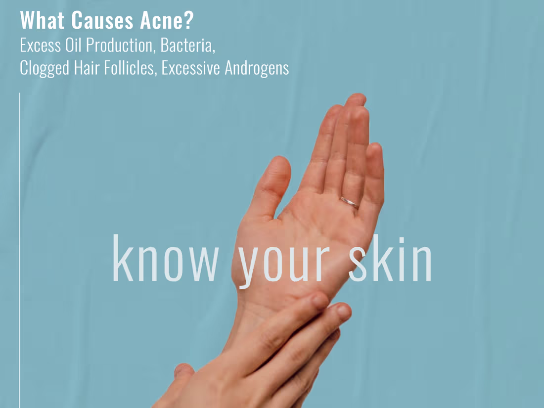 Cover image for Brand Identity - ILYNN SKINCARE