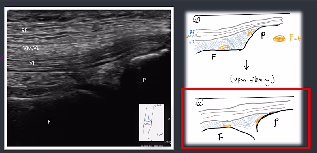 Cover image for Translator Specialize in Medicine (CH<->EN)